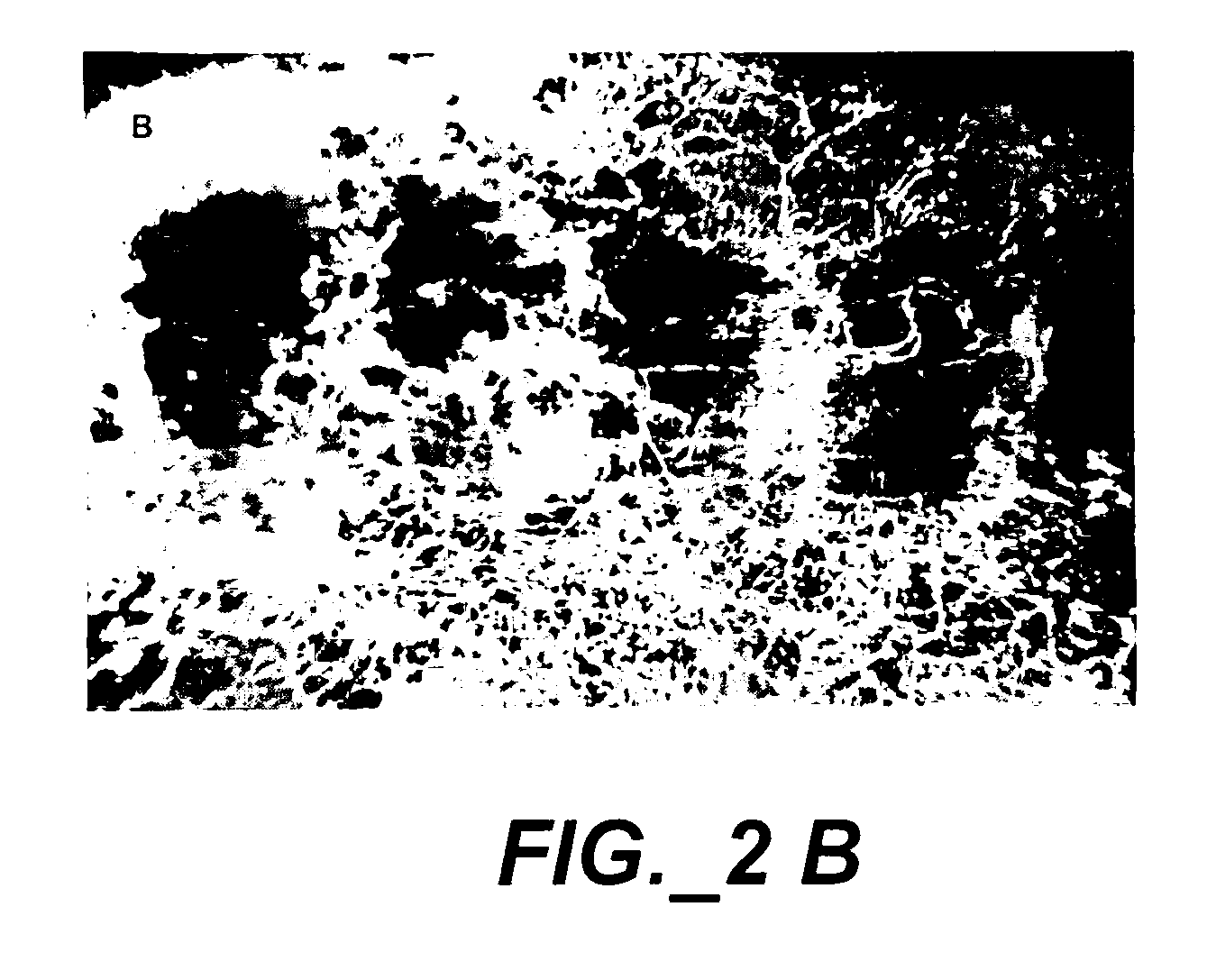 Composition and Method for Preventing Secondary Burn Ischemia