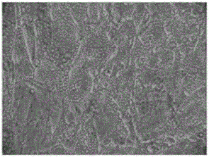 Multifunctional menstrual blood stem cell culture method