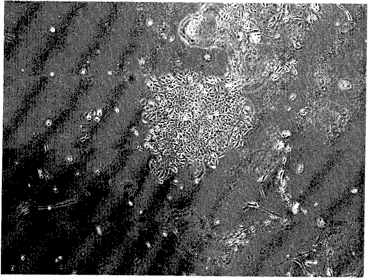 Liver cancer cell system from liver cancer portal vein tumor thrombus of human and system establishing method thereof