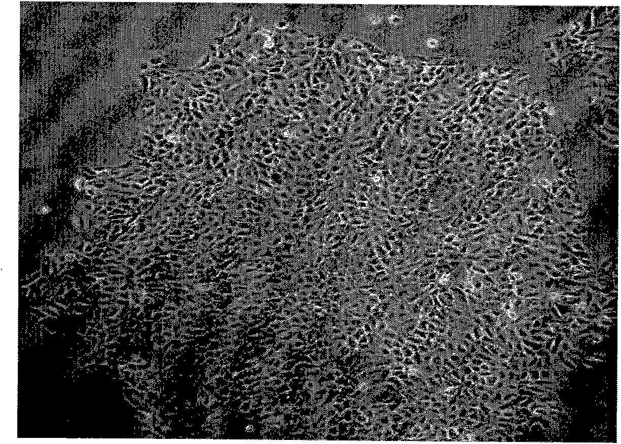 Liver cancer cell system from liver cancer portal vein tumor thrombus of human and system establishing method thereof