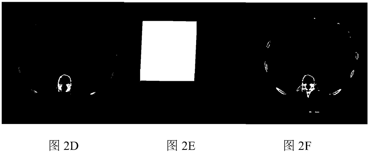 CT image based automatic extraction method of 3D liver bounding volume