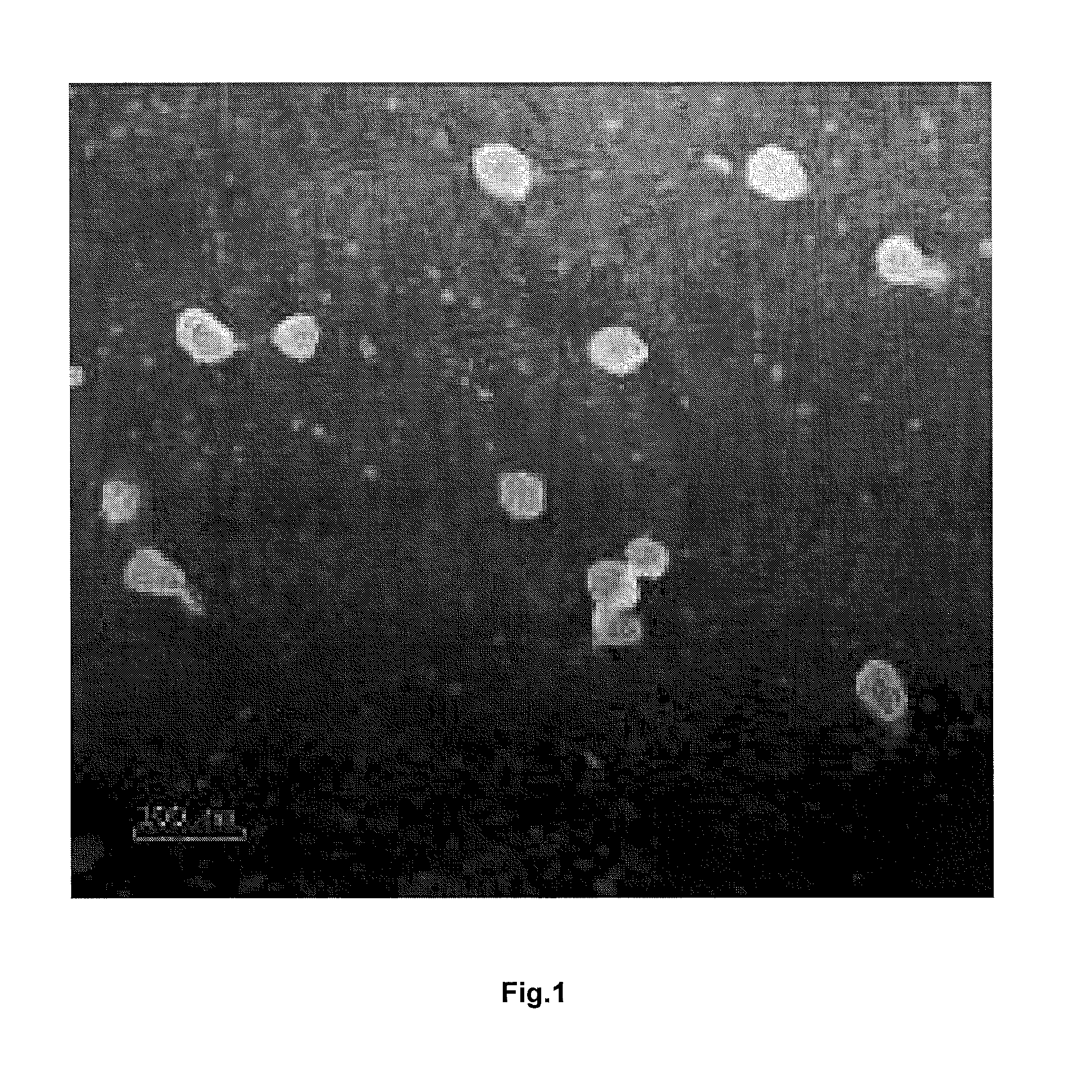 Traditional chinese medicine compound antitumor NANO preparation and use thereof