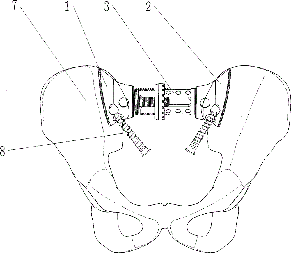 Adjustable self-stabilizing type artificial sacrum prosthesis