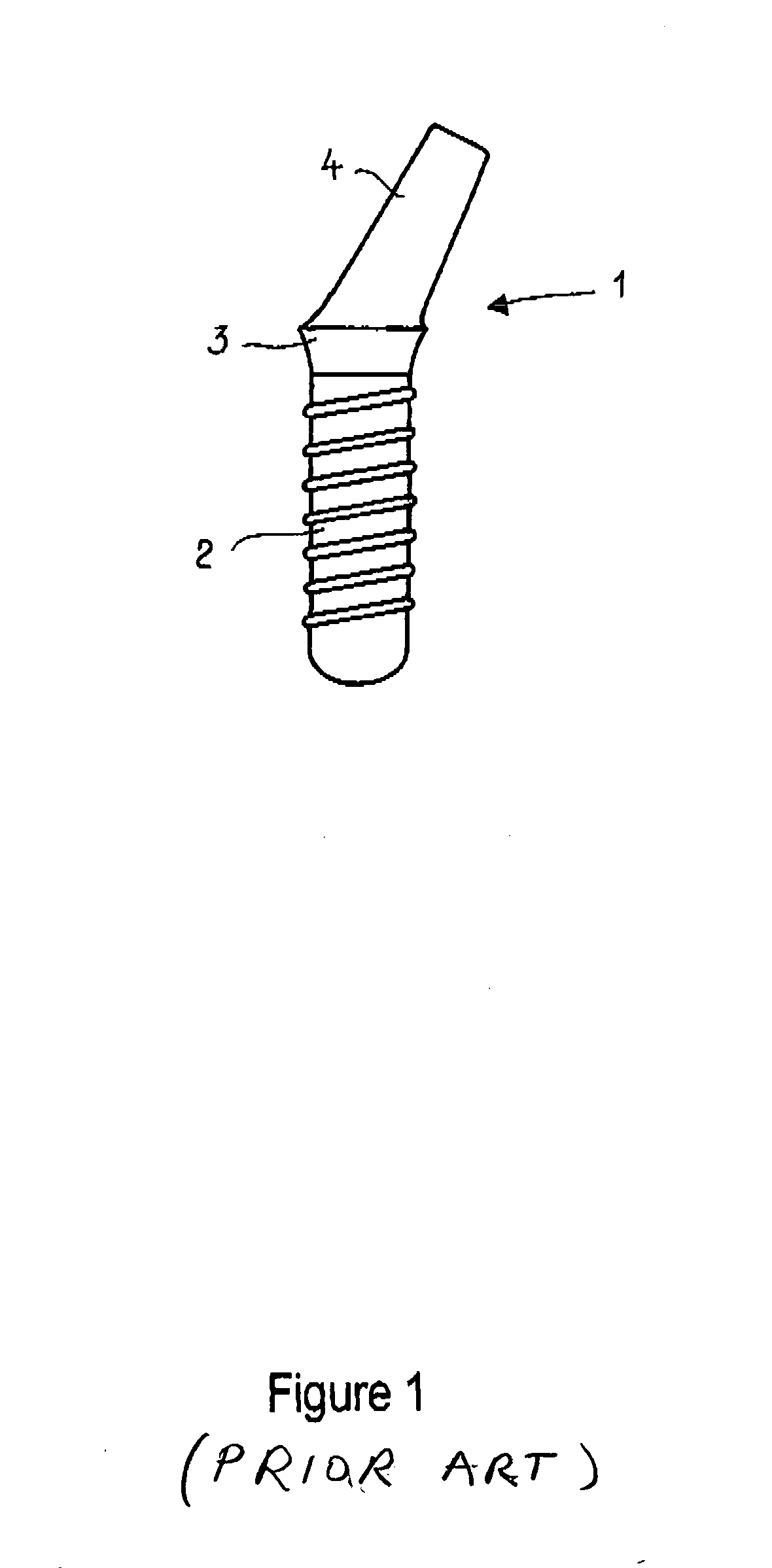 Try-in implant with angulated attachment portion