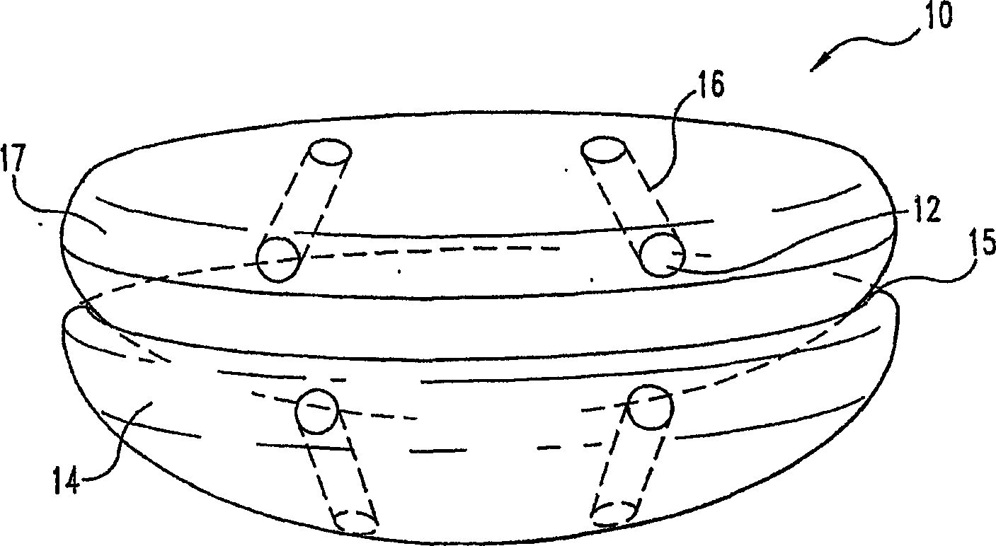 Implants based on engineered metal matrix composite materials having enhanced imaging and wear resistance