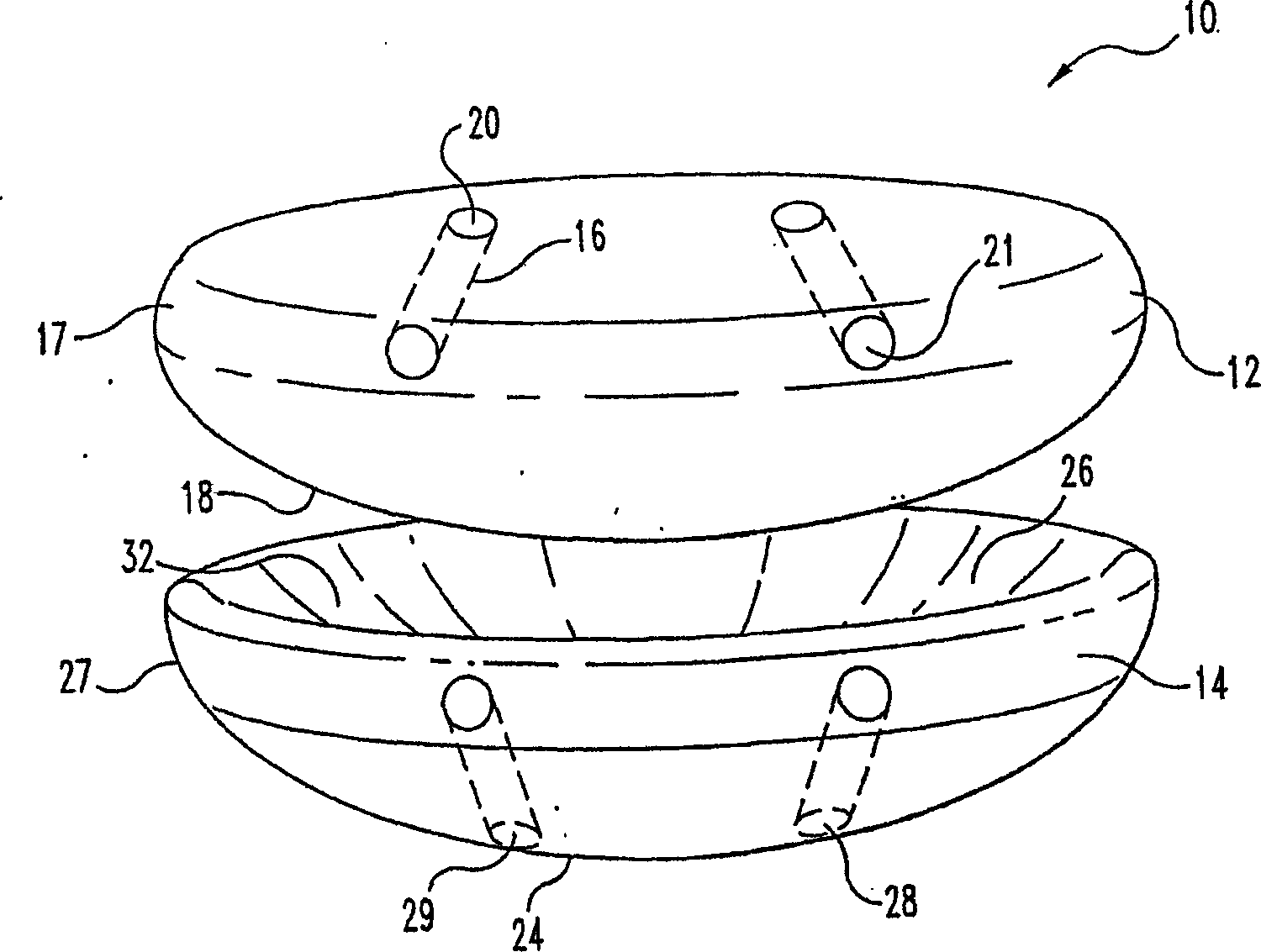 Implants based on engineered metal matrix composite materials having enhanced imaging and wear resistance