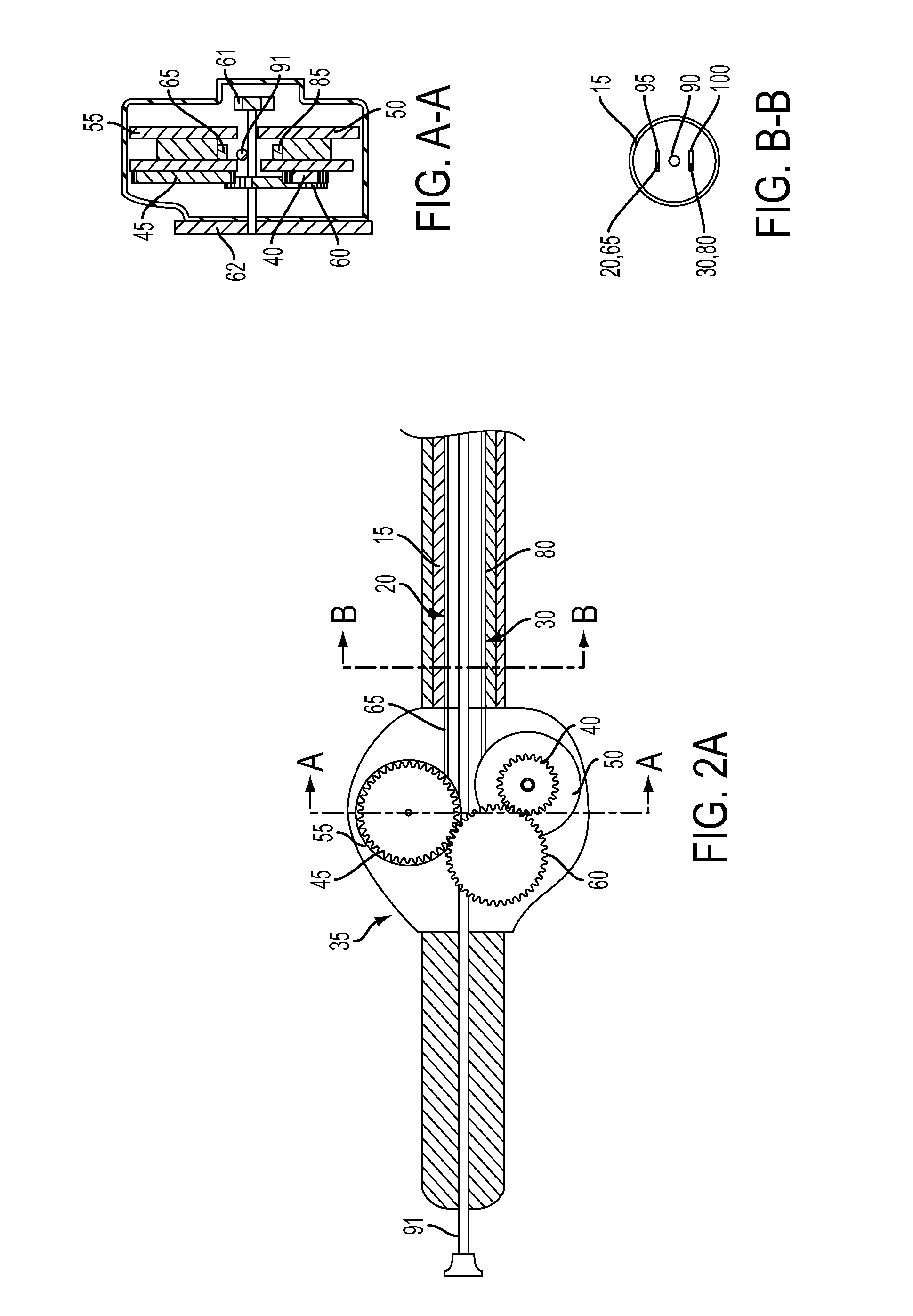 Stent Deployment Device and Methods for Use