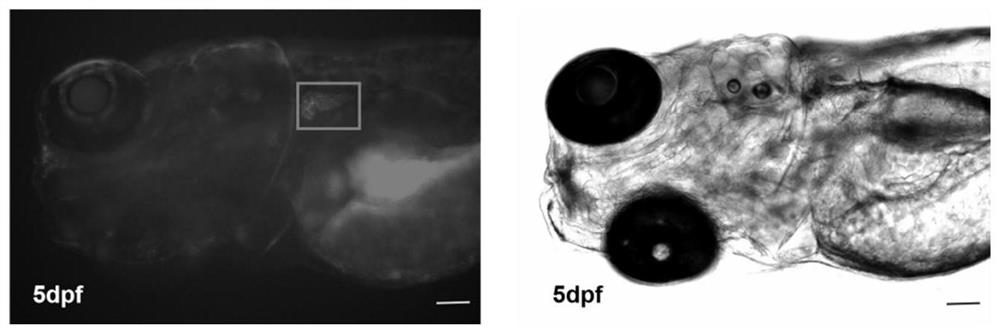 Preparation method and application of transgenic zebra fish capable of specifically removing T cells