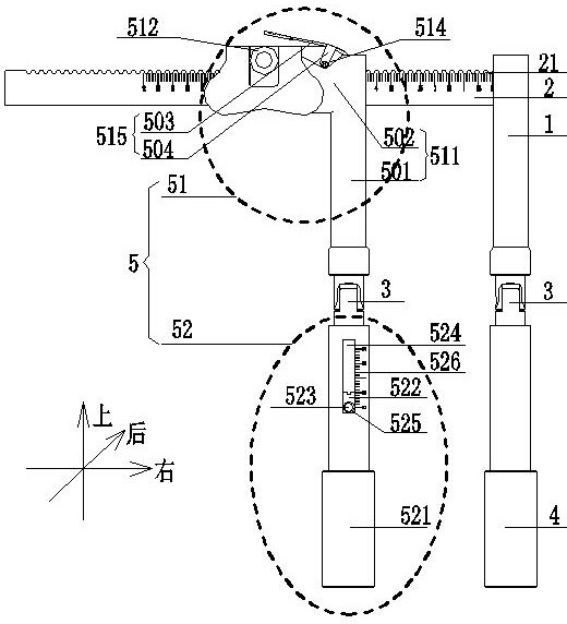 Quantifiable distraction lifting device for lumbar spondylolisthesis reduction