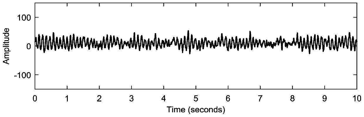 Method for simultaneously removing multiple artifacts from single-channel electroencephalogram signals