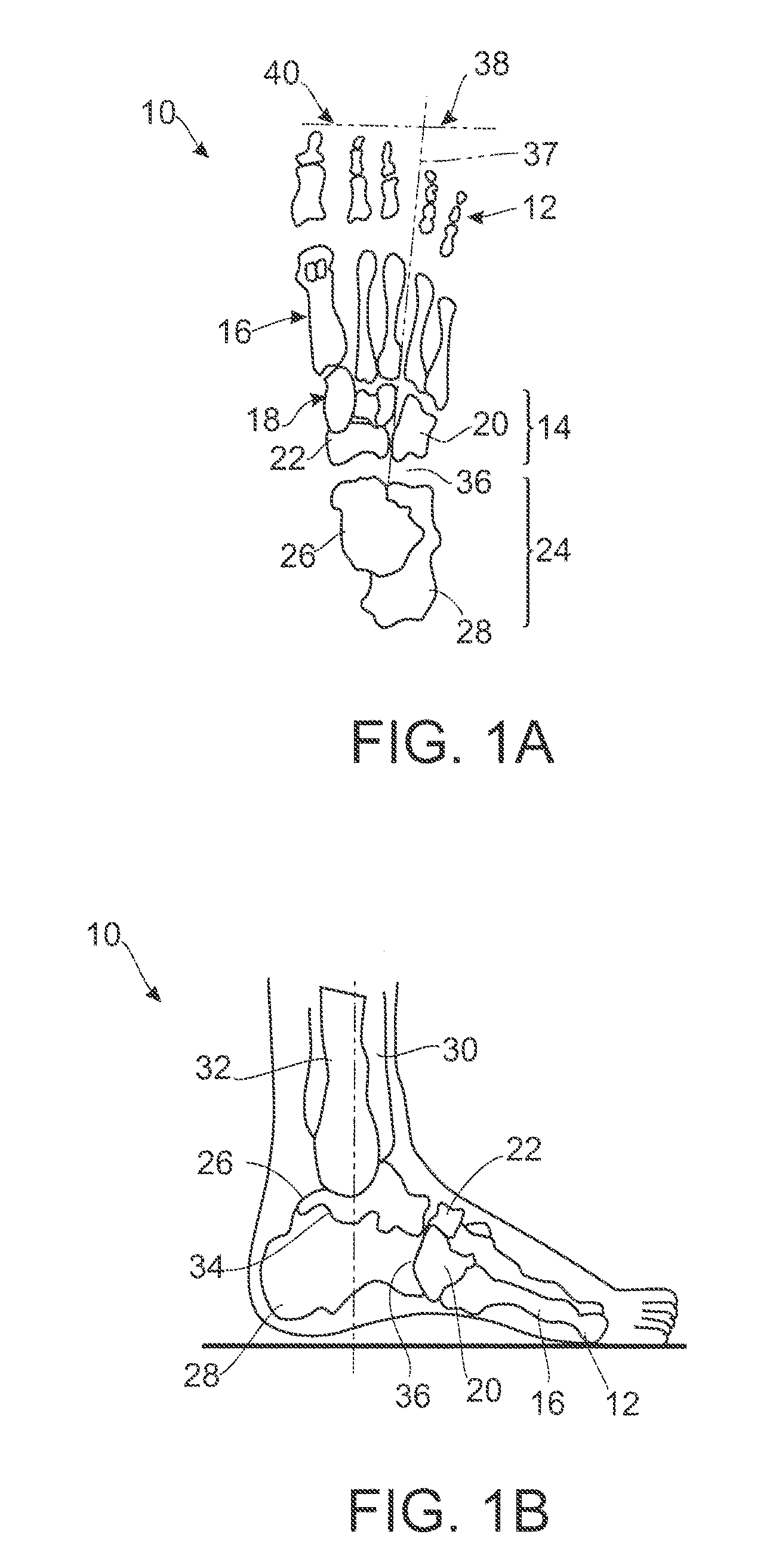 Apparatus for adjusting foot structures, for design of a foot orthotic, and methods of use