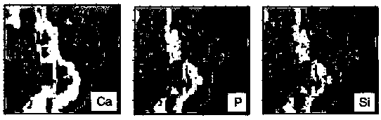 Preparation method of regenerated medical material for bone and soft tissue bonding and restoration