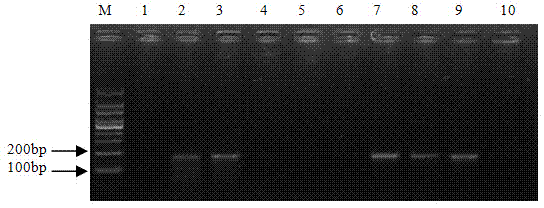 Pair of specific molecular detection primers for undifilum oxytropis and detection method