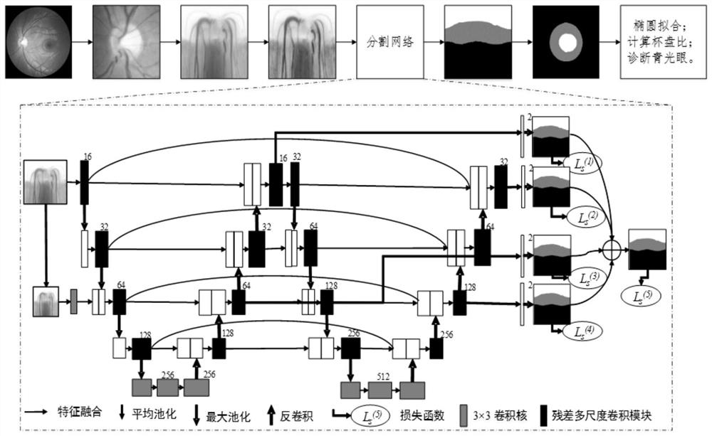 Fundus image optic cup optic disc segmentation method and system for assisting glaucoma screening