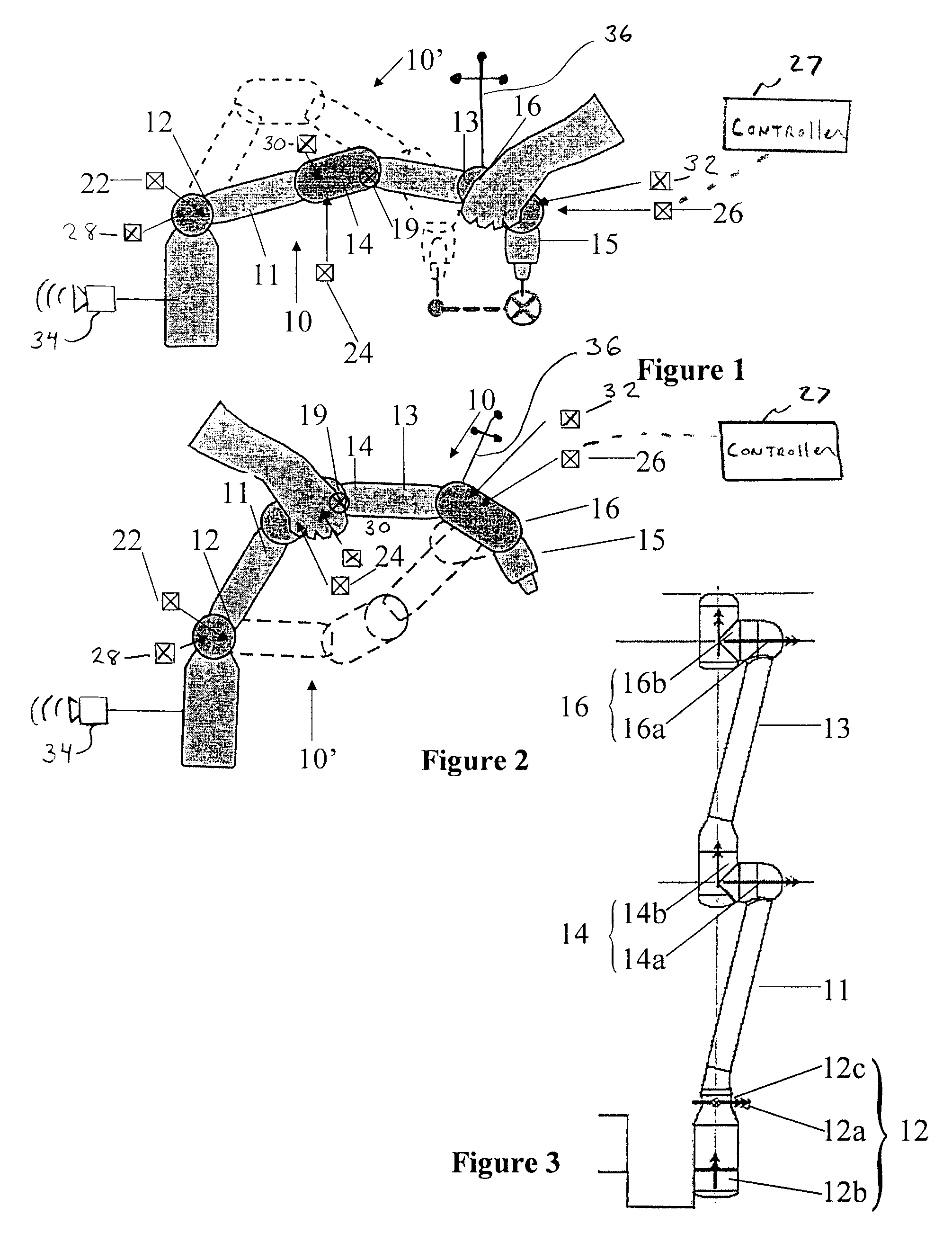 Anthropomorphic medical robot arm with movement restrictions