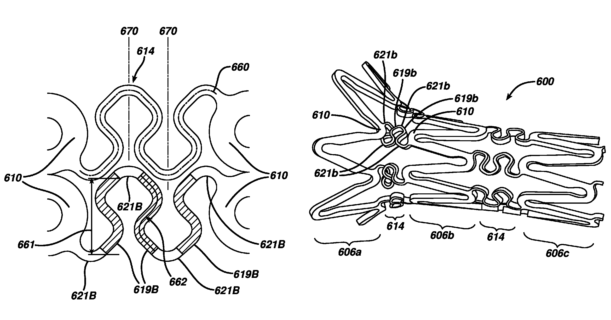 Optimized flex link for expandable stent