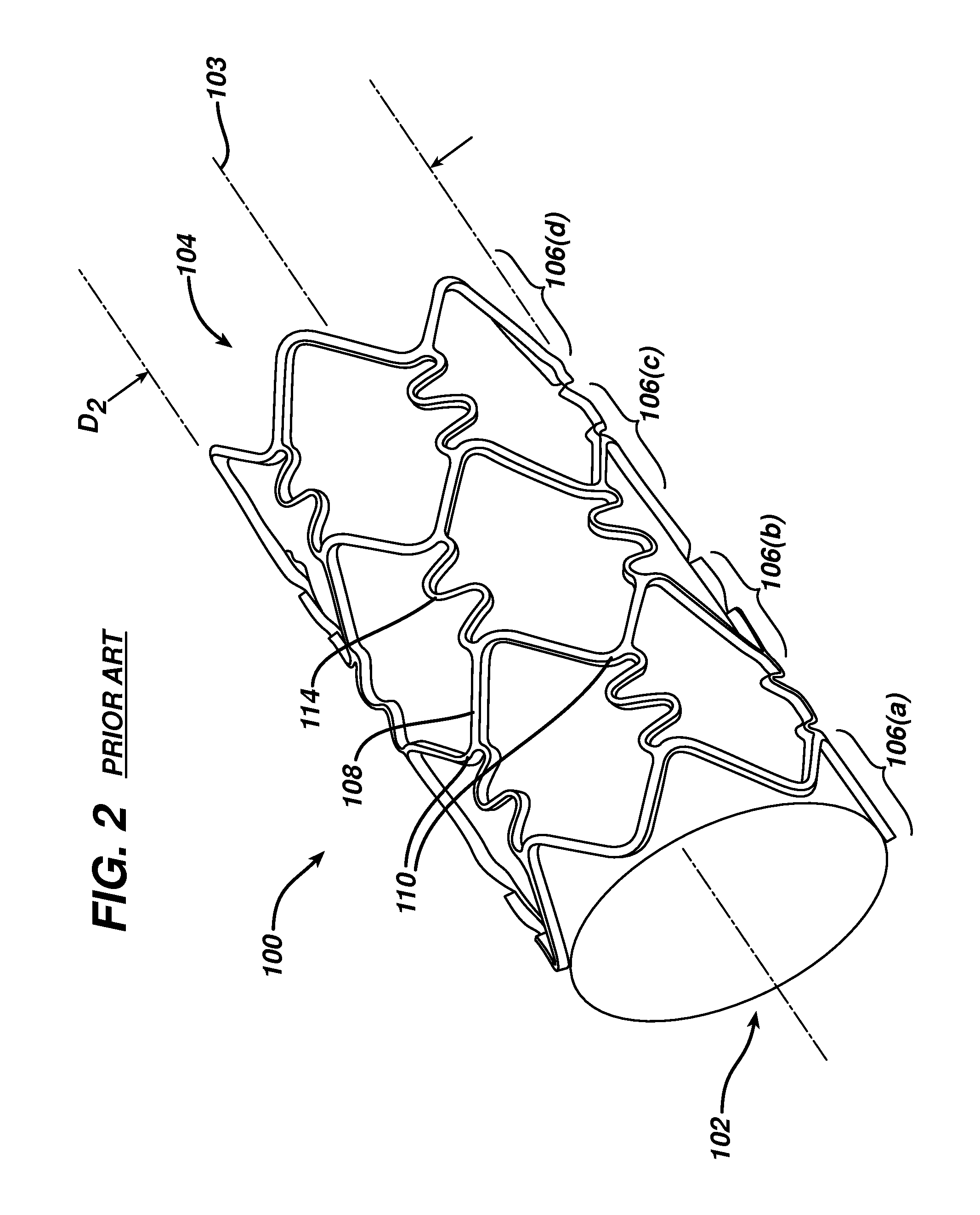 Optimized flex link for expandable stent