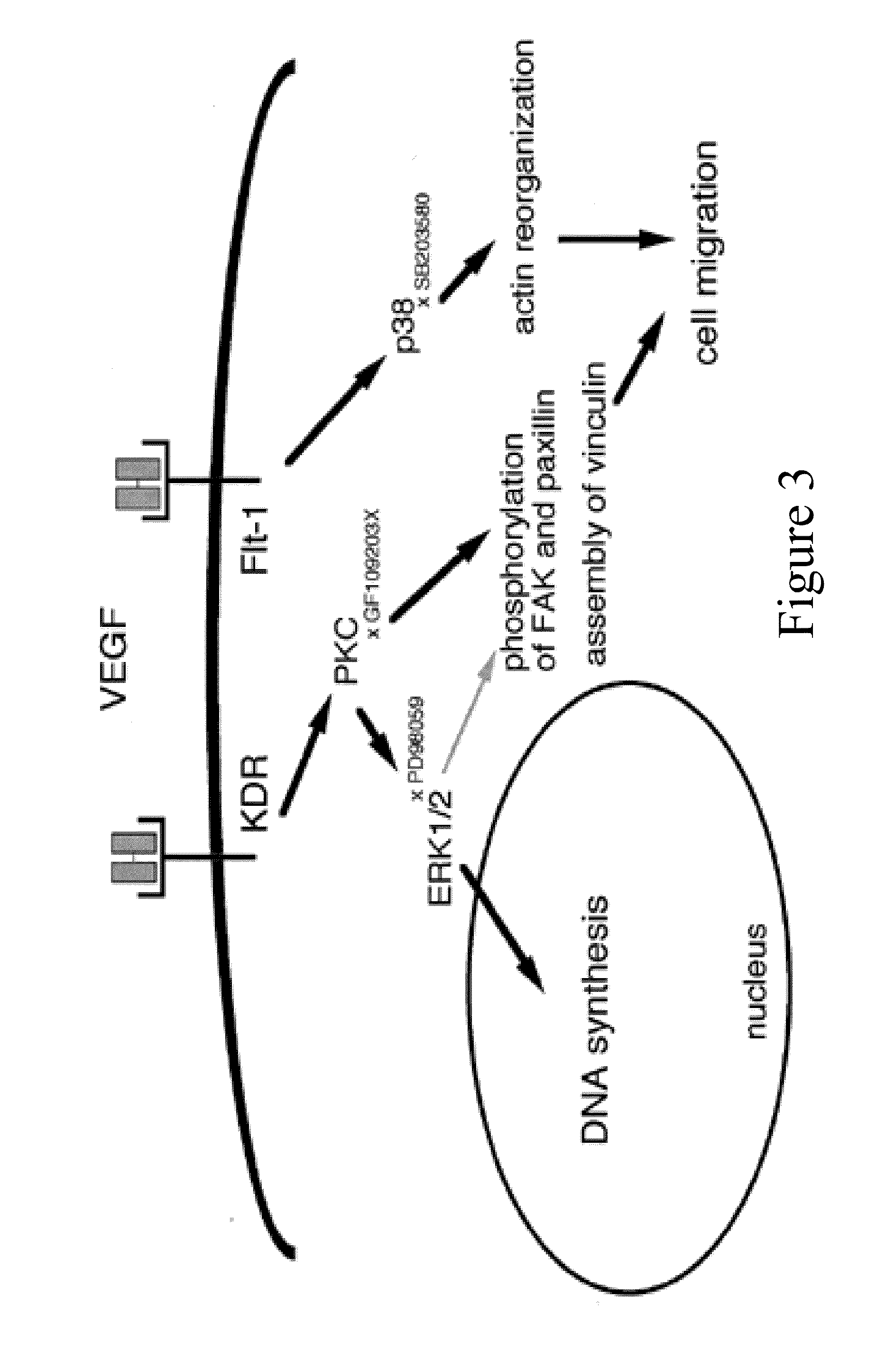 Use of angiogenesis antagonists in conditions of abnormal venous proliferation