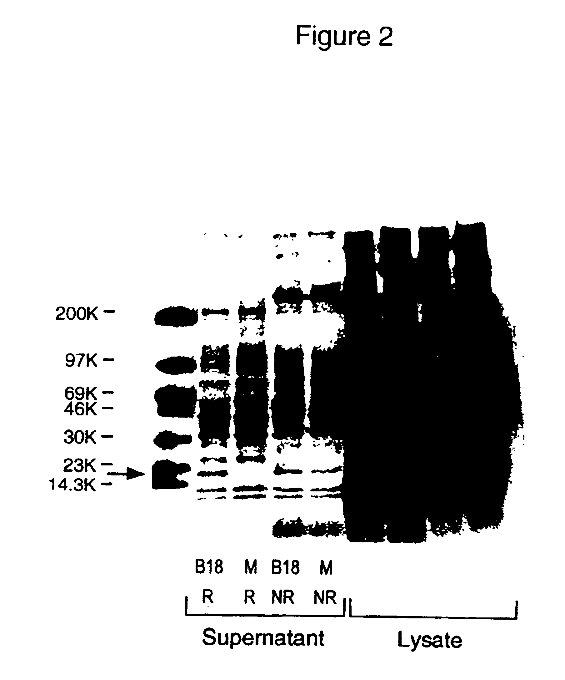 Antibodies to human IL-17F and other CTLA-8-related proteins