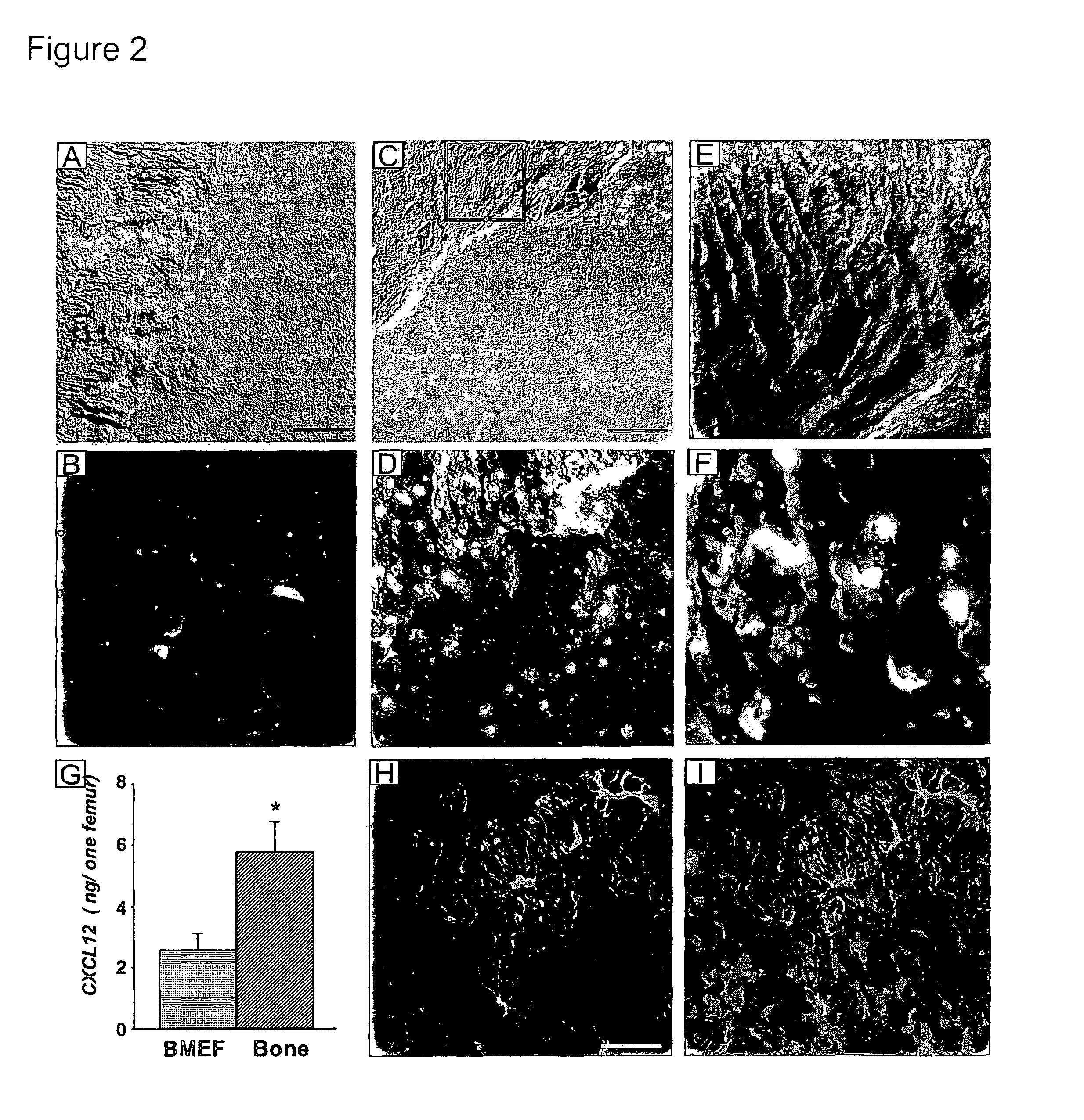 Methods and compositions for modulating the mobilization of stem cells