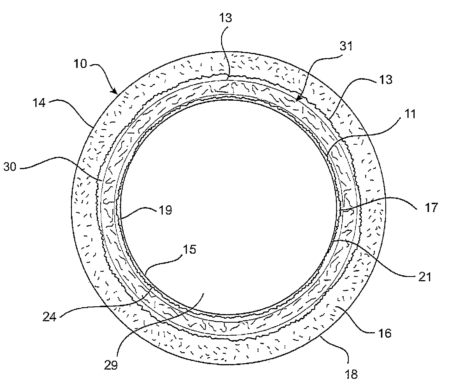 Construction of pipes