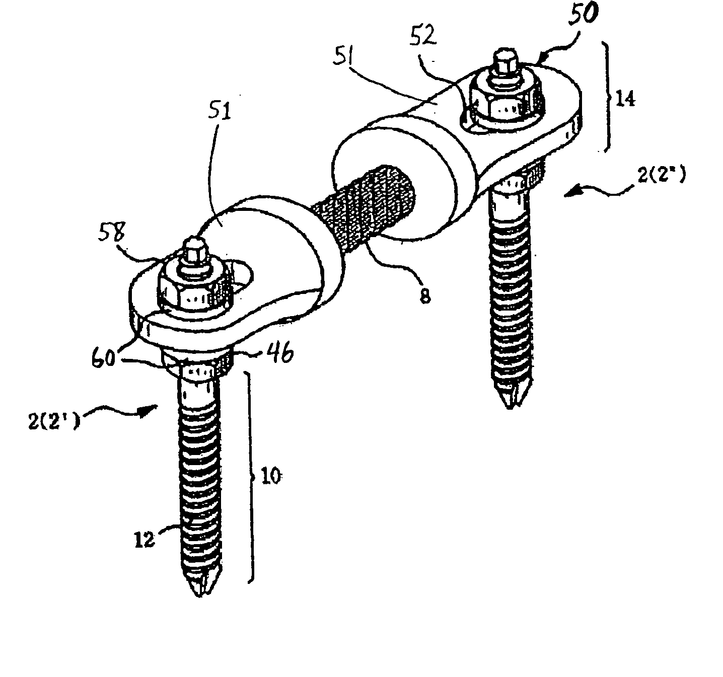 Method and apparatus for flexible fixation of a spine