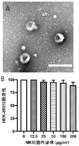 Application of NK cell exosome and related miRNA in preparation of COVID-19 virus inhibitor