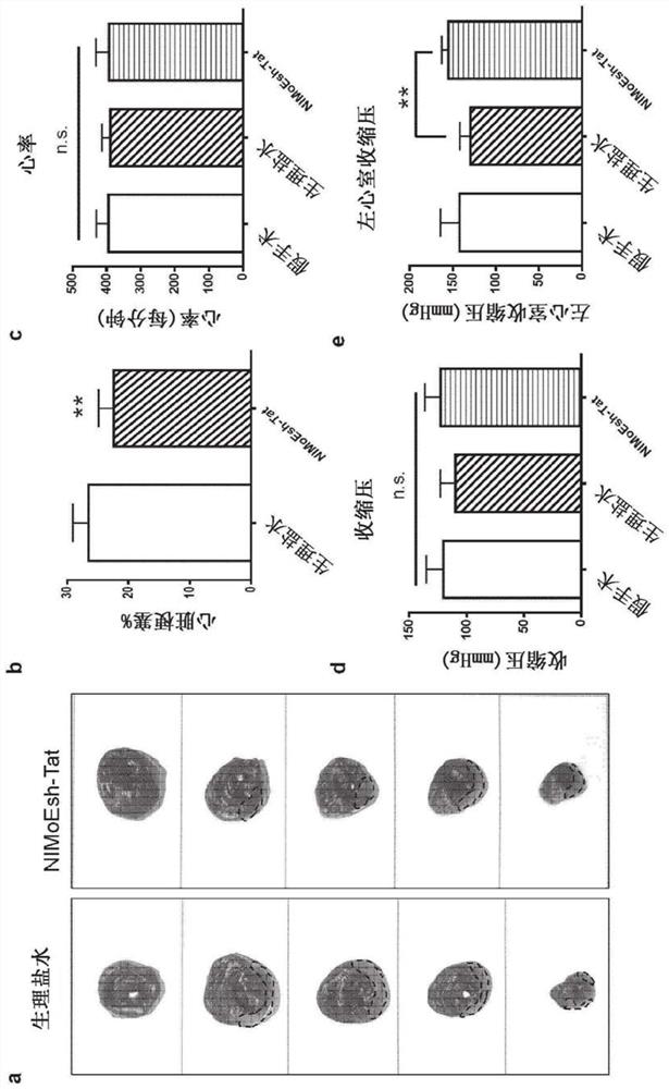 Inhibition of ZD17-JNK interaction as therapy for acute myocardial infarction