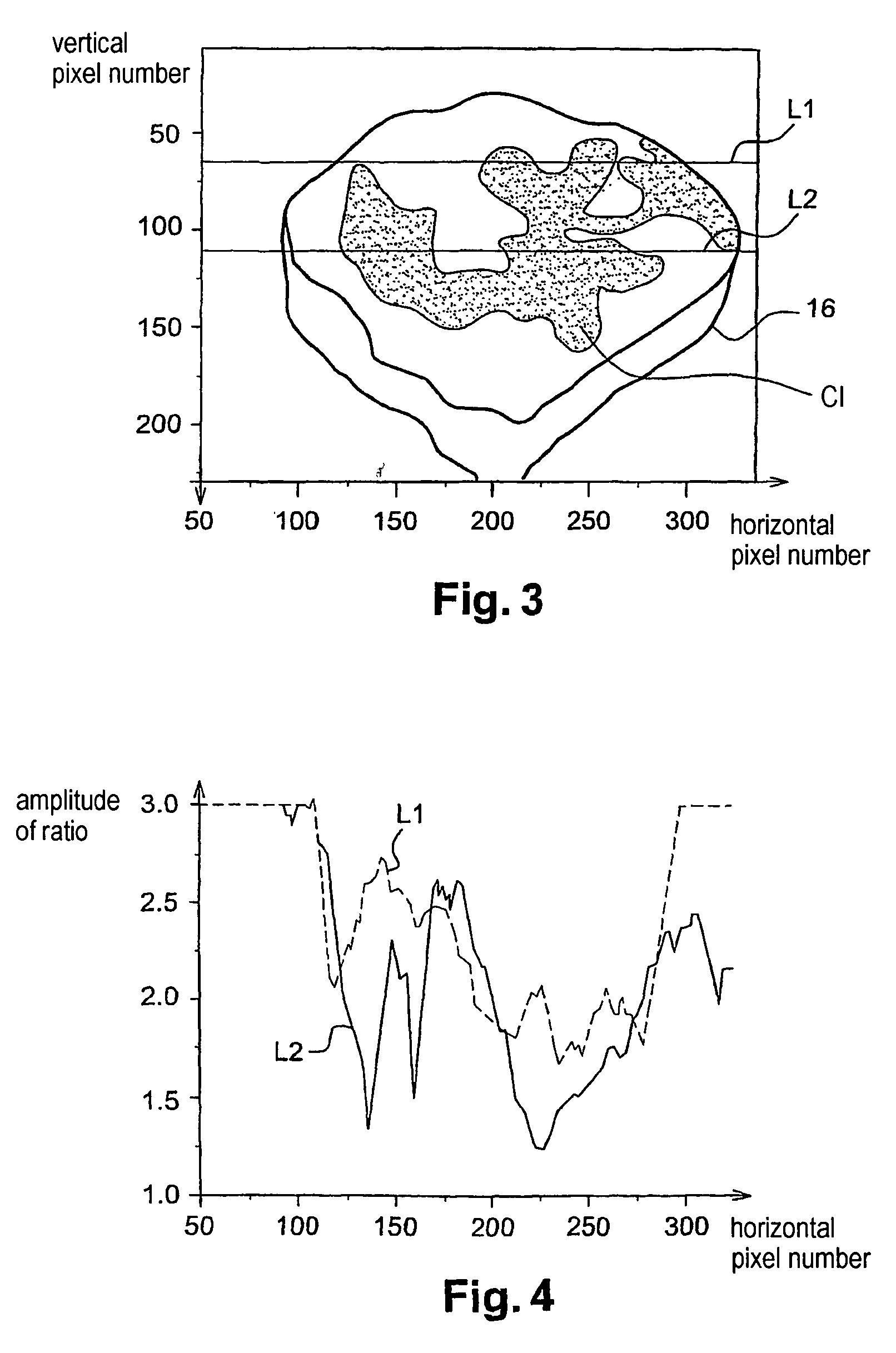 Method and apparatus for acquiring and processing images of an article such as a tooth