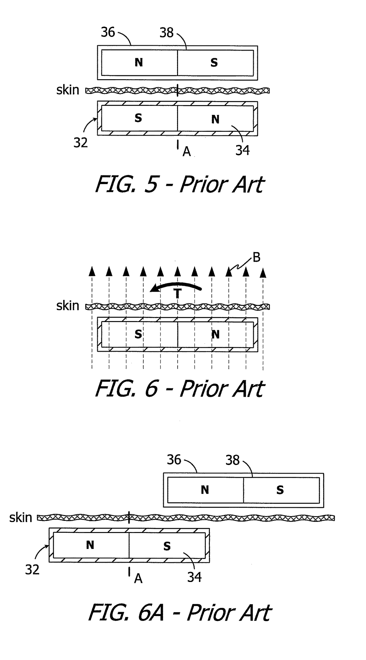 Cochlear implants having mri-compatible magnet apparatus and associated methods