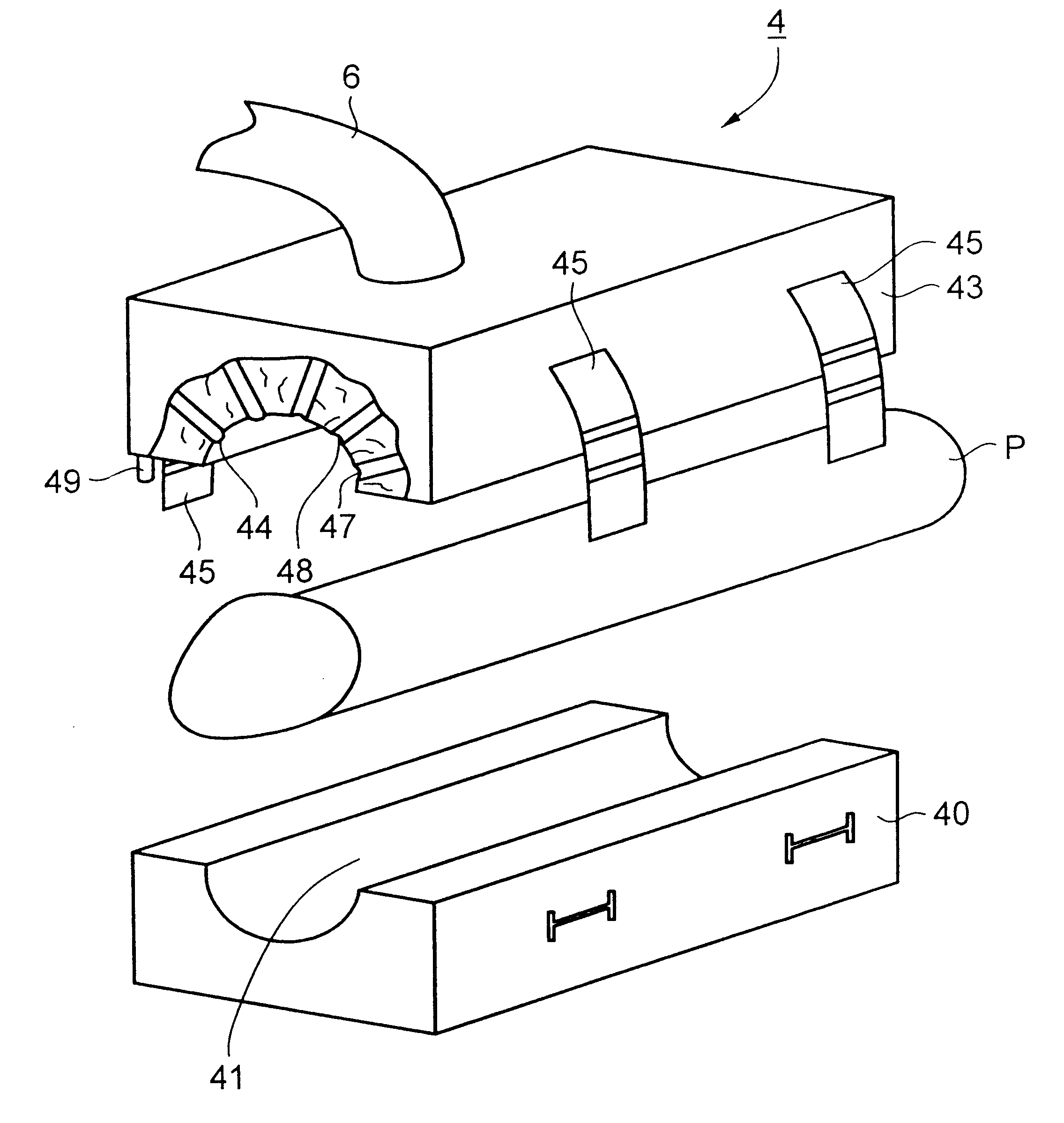 Method of treating for impotence and apparatus particularly useful in such method