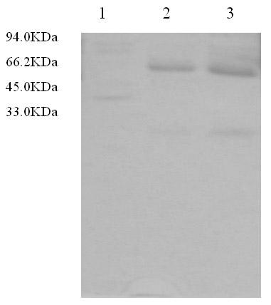 Mycobacterium tuberculosis antibody binding peptide and application thereof