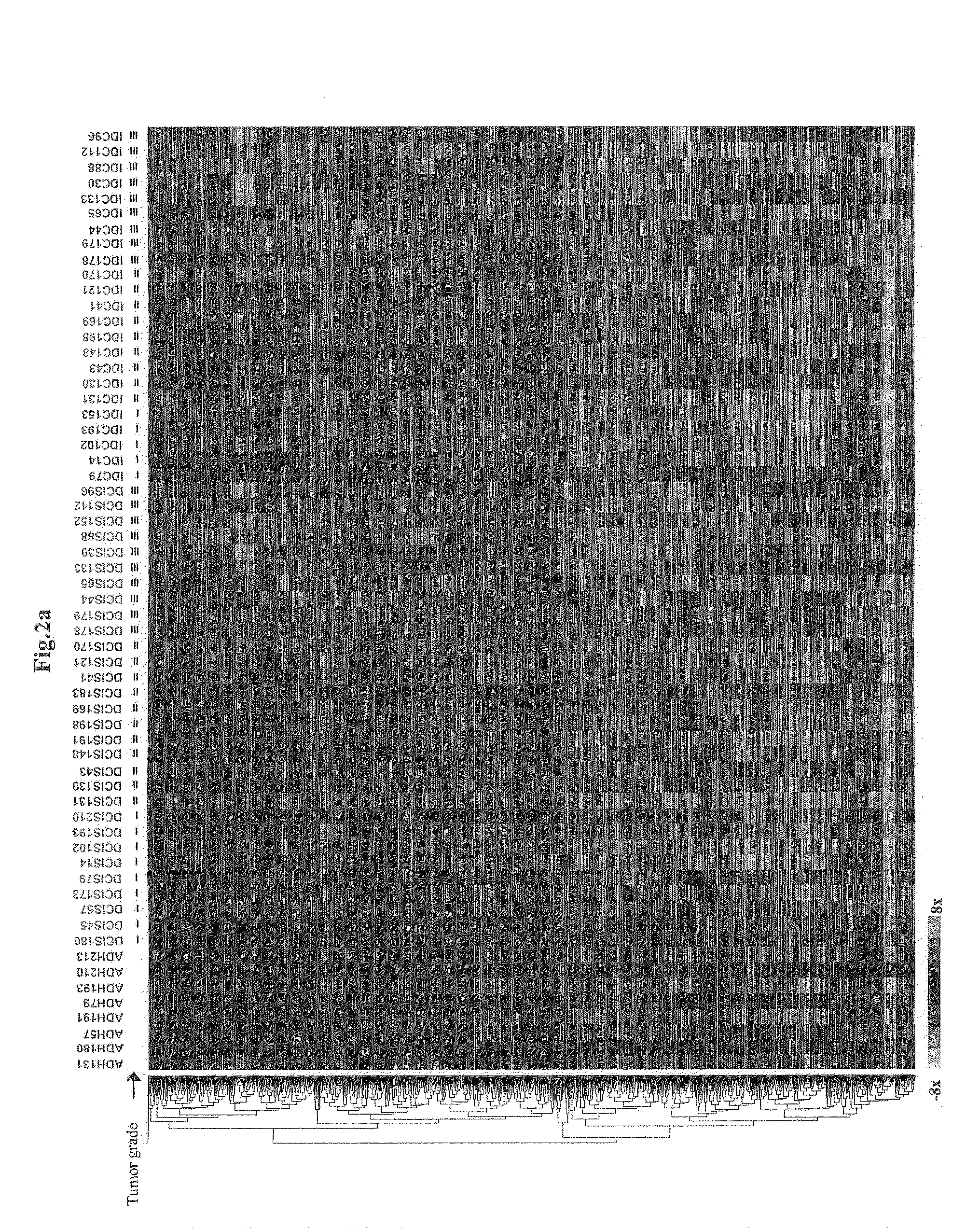 Grading of Breast Cancer