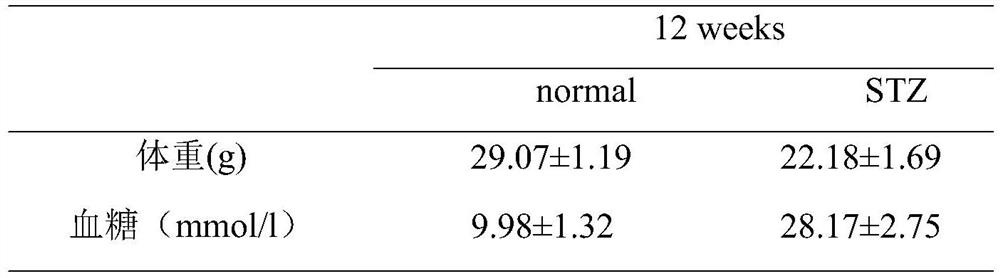 Pterostilbene nano eye drops and preparation method thereof