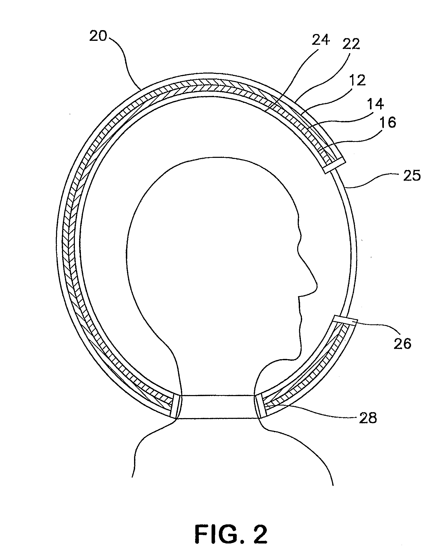 Protective enclosure