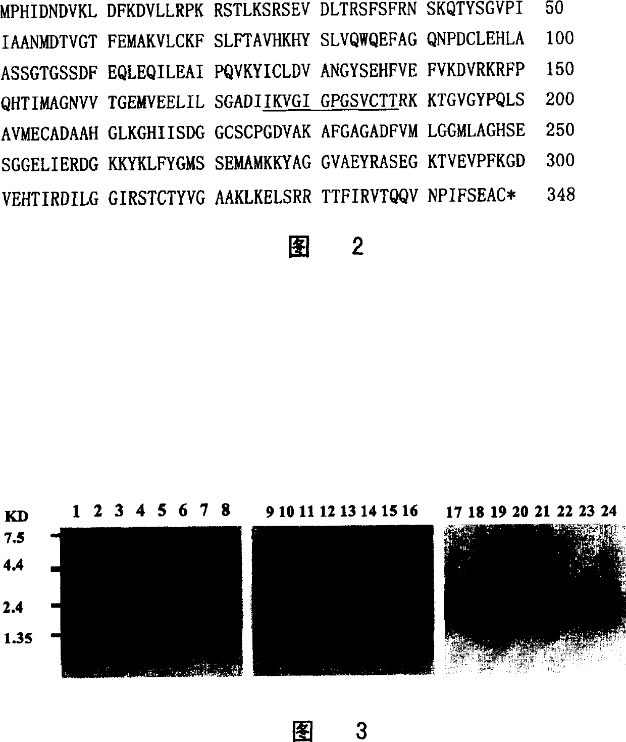 New human-phosphoguanosine reductase, its coding sequence and application