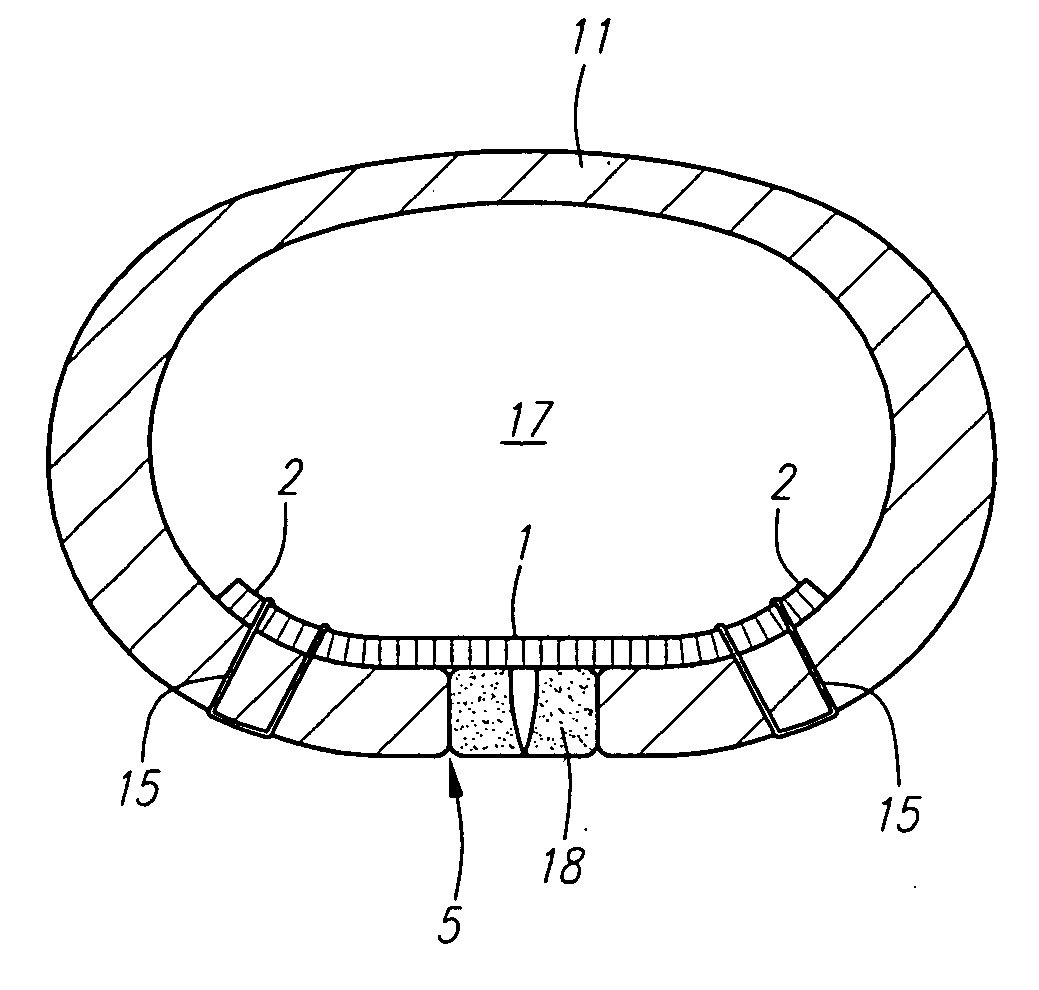 Methods and apparatus for reconstructing the anulus fibrosus