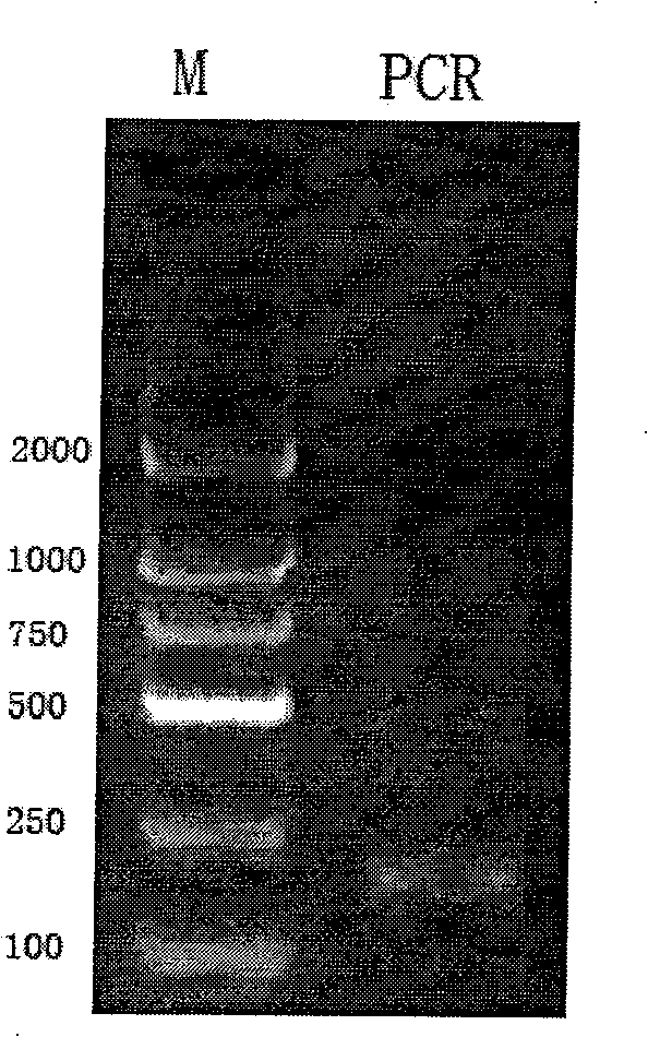 Recombination NuBCP-9 and Tumstatin(74-98) antitumor fusion polypetide