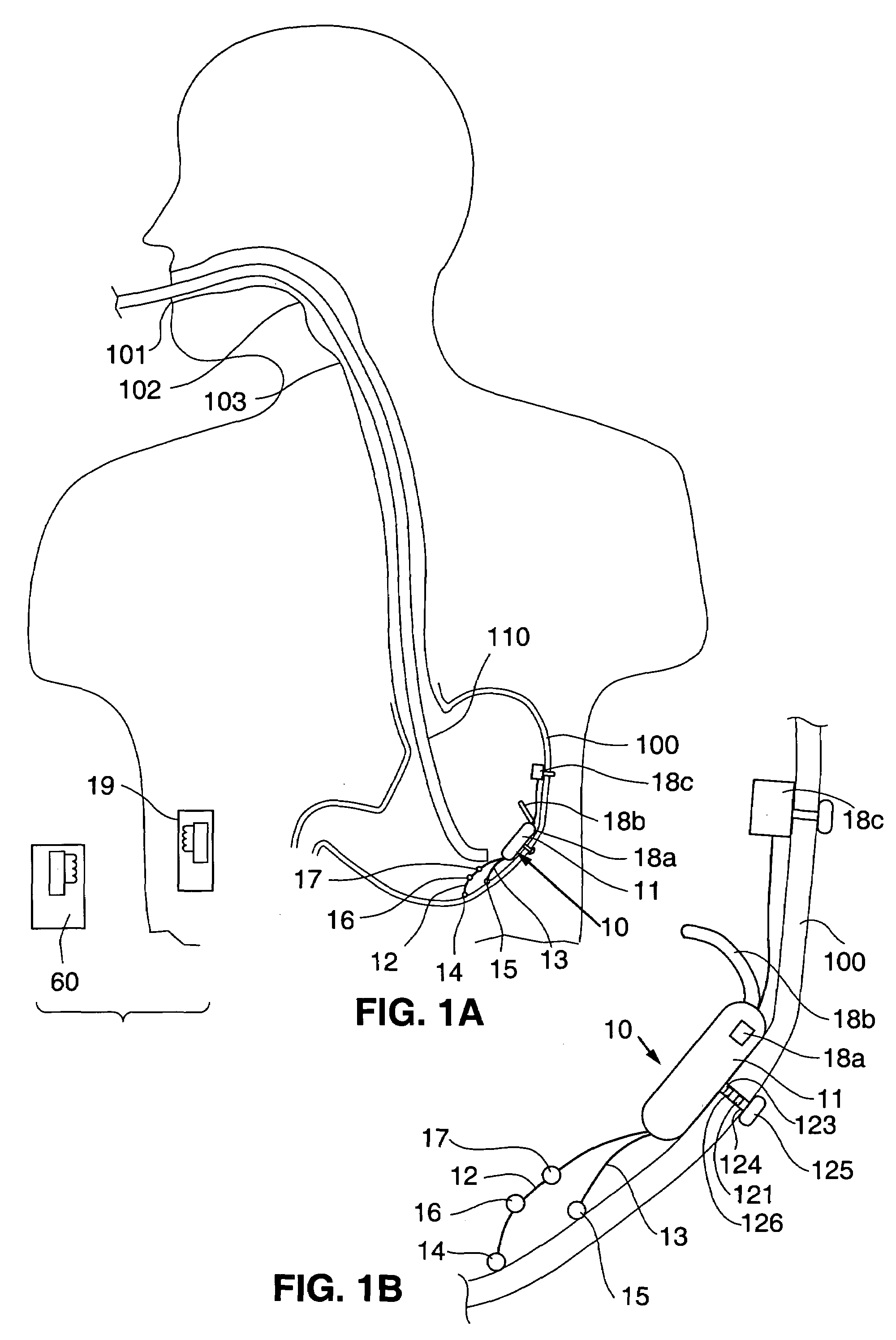 Responsive gastric stimulator