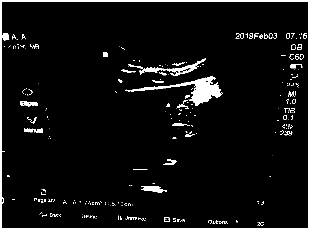 Instant rice noodles for pregnant woman to eat before being in labor and making method and application thereof