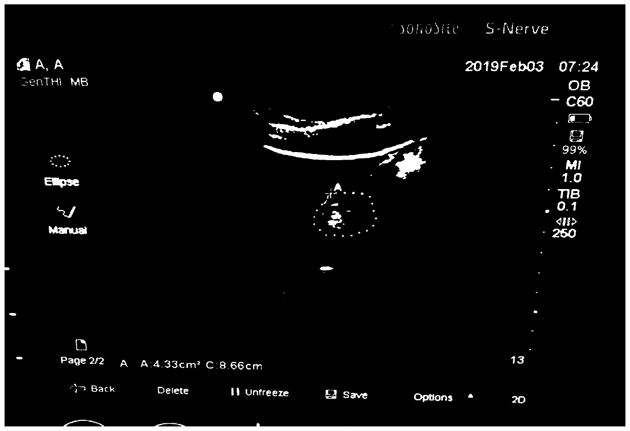 Instant rice noodles for pregnant woman to eat before being in labor and making method and application thereof