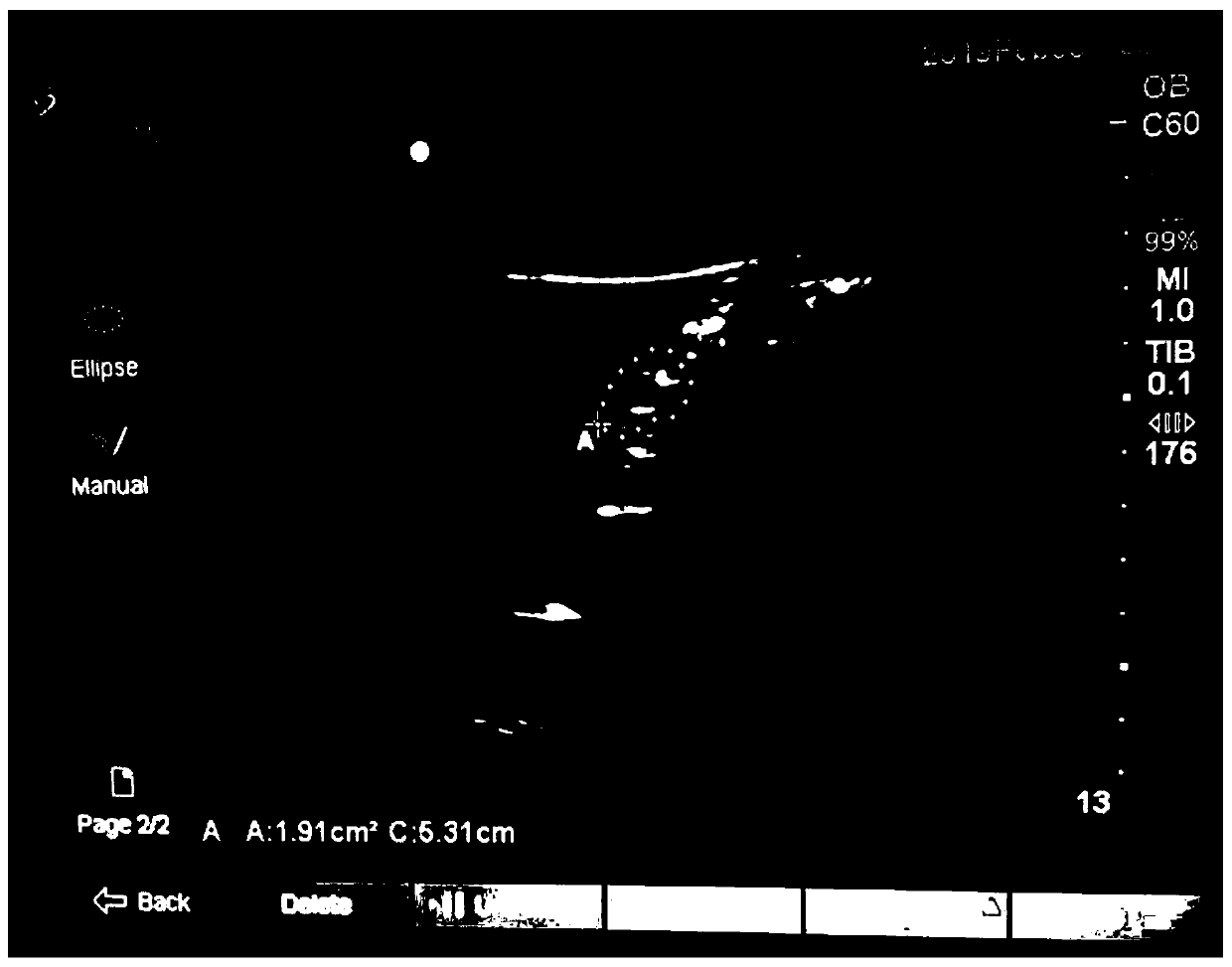 Instant rice noodles for pregnant woman to eat before being in labor and making method and application thereof