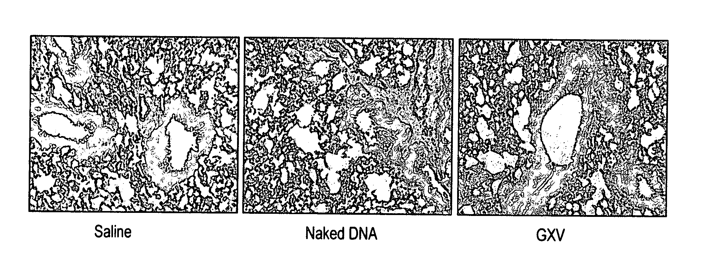 Gene expression vaccine