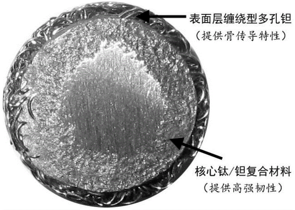 Titanium and tantalum composite microsphere bone filling medical material