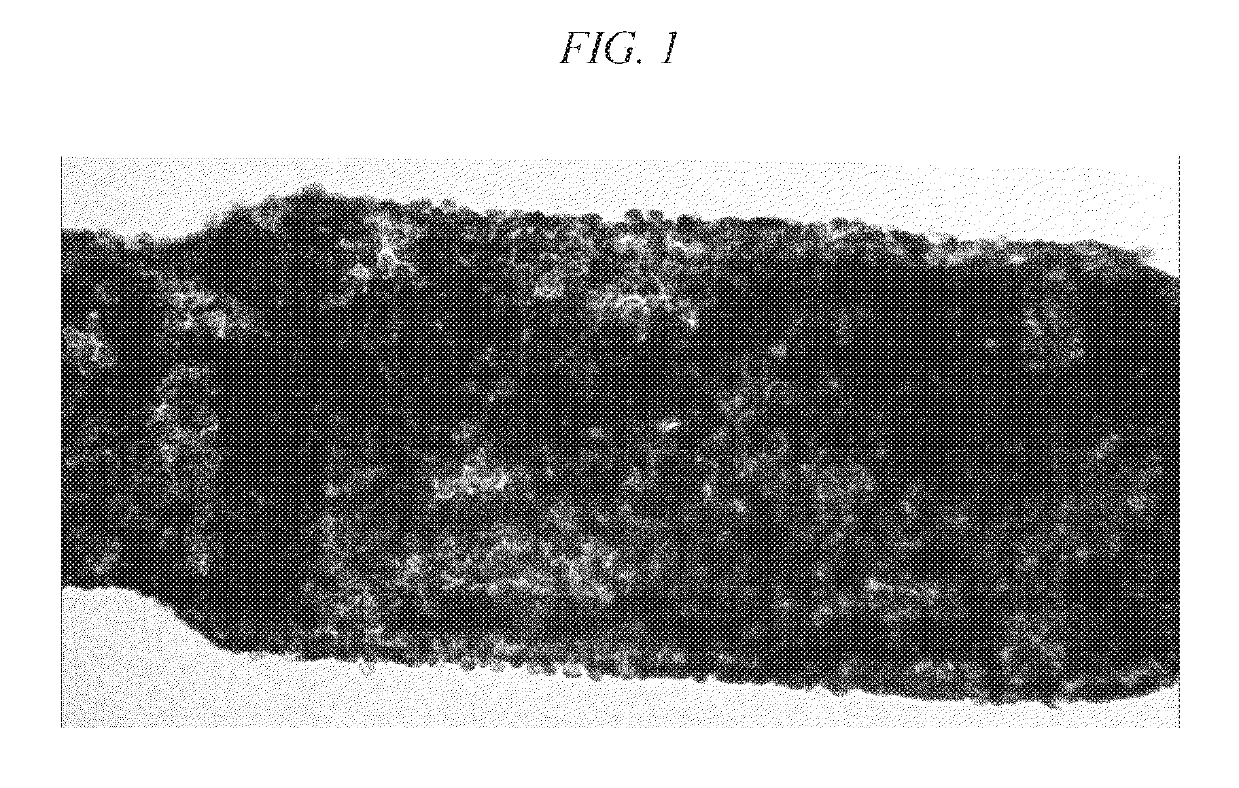 Method of cryopreservation of stem cell-derived retinal pigment epithelial cells on polymeric substrate