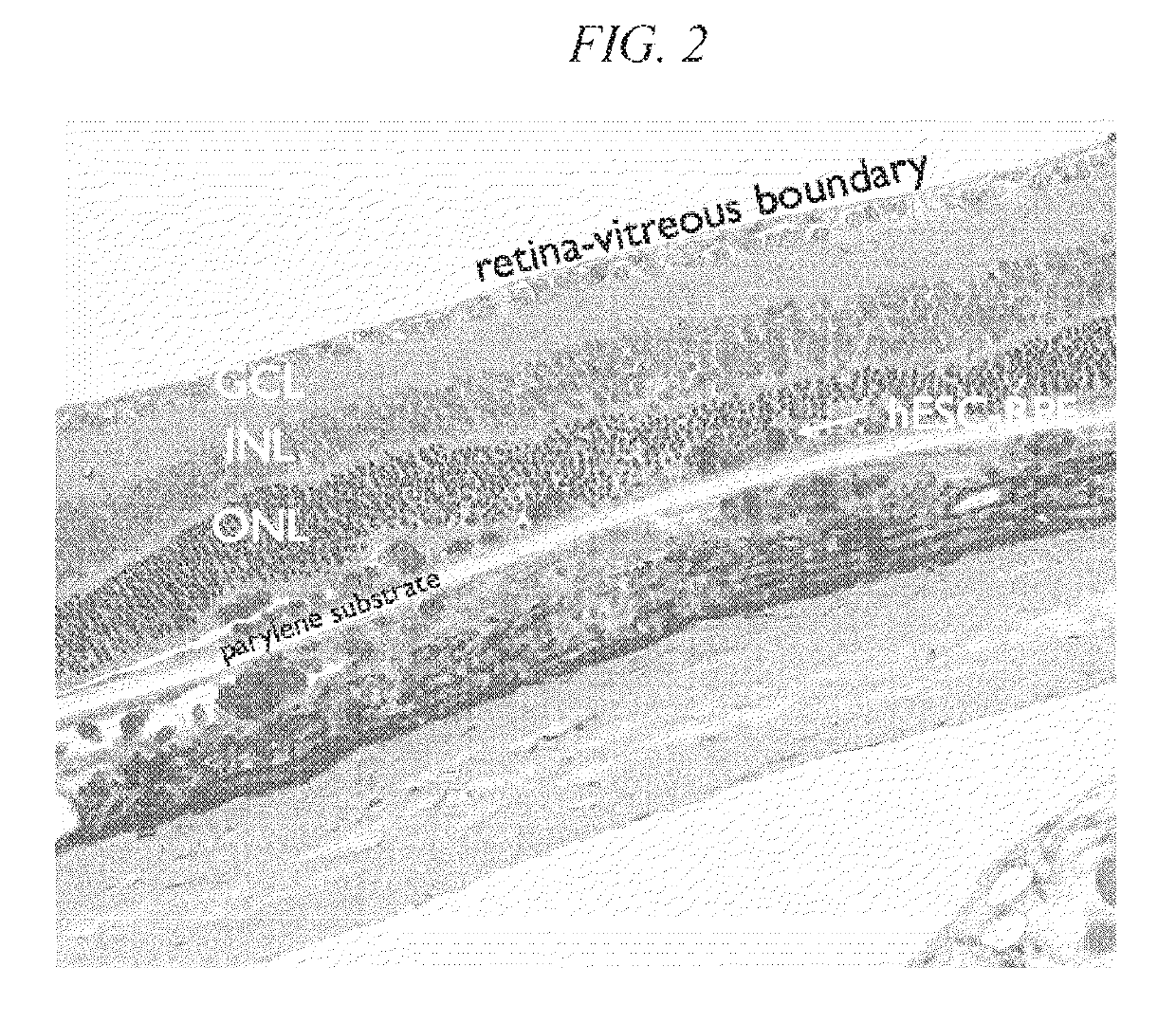 Method of cryopreservation of stem cell-derived retinal pigment epithelial cells on polymeric substrate