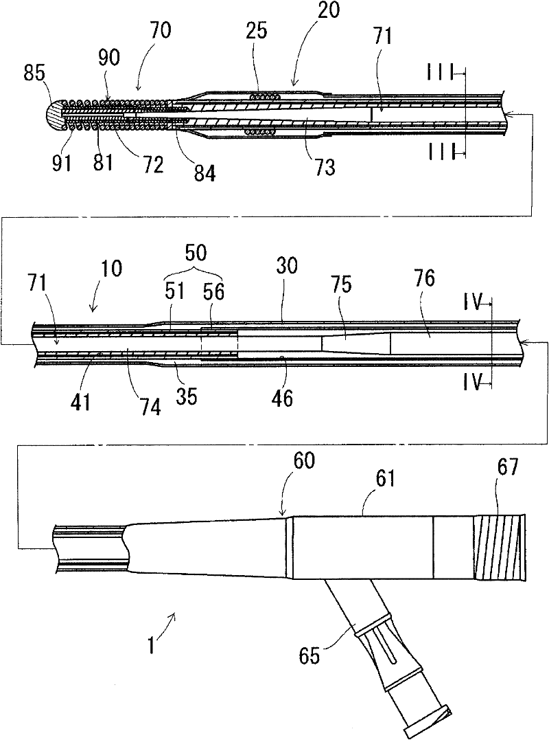 balloon catheter