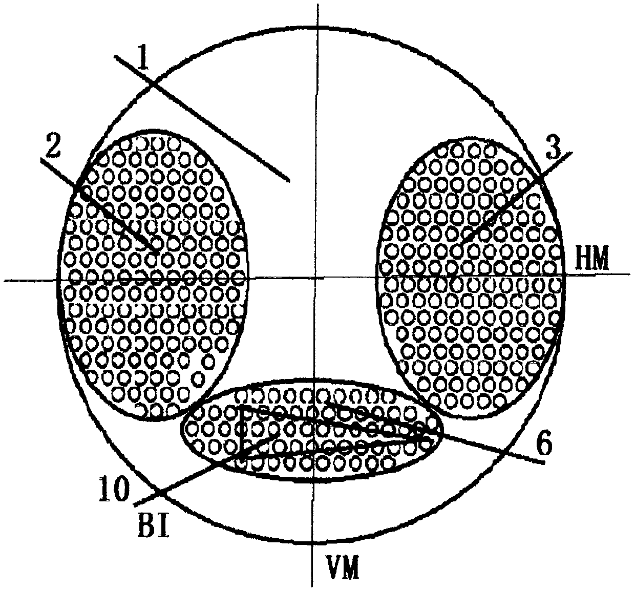 Micro-lens peripheral out-of-focus spectacle lens