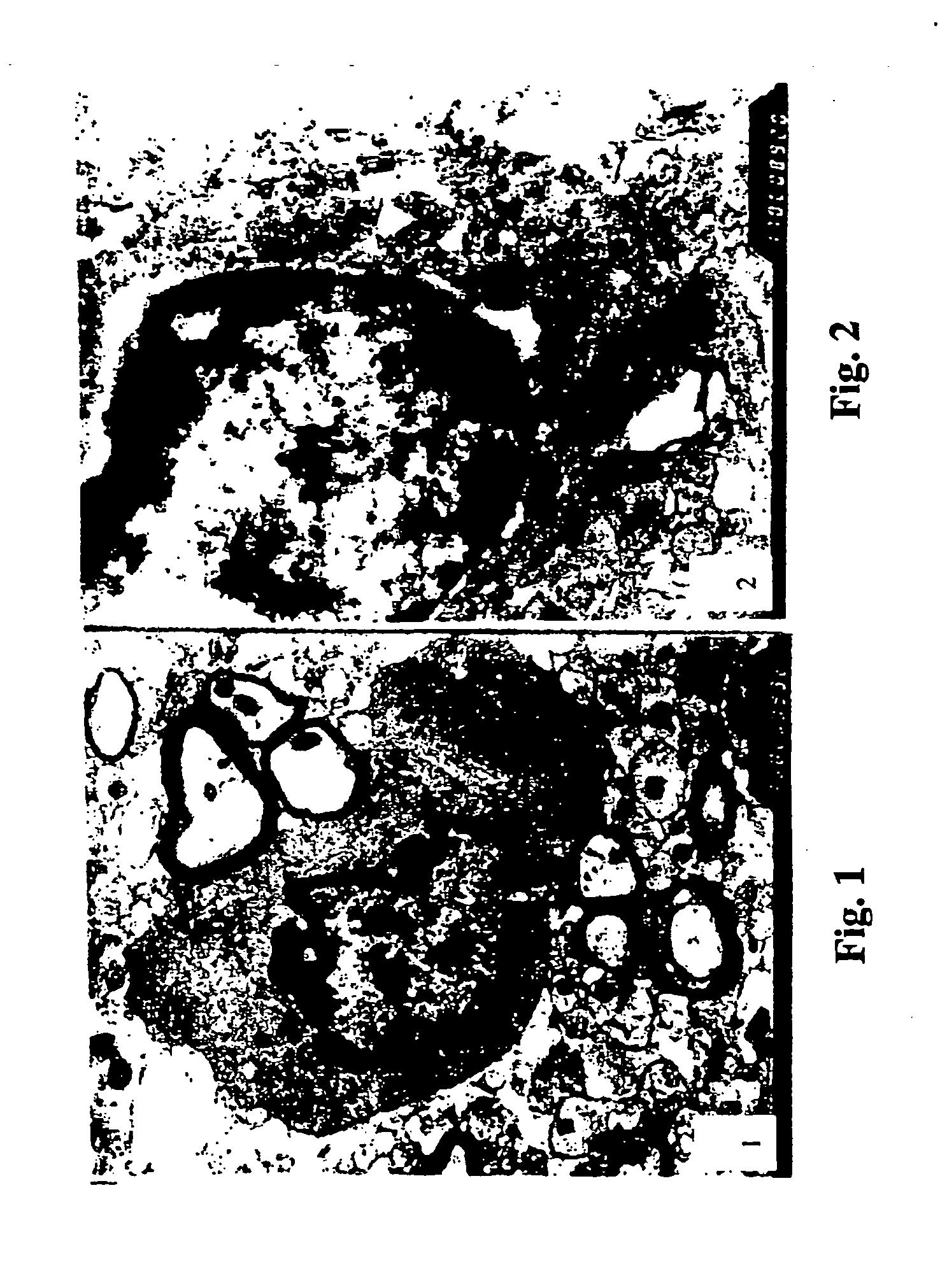 Sporoderm-broken germination-activated ganoderma lucidum spores for protection of dopaminergic neurons and treatment of Parkinson's disease