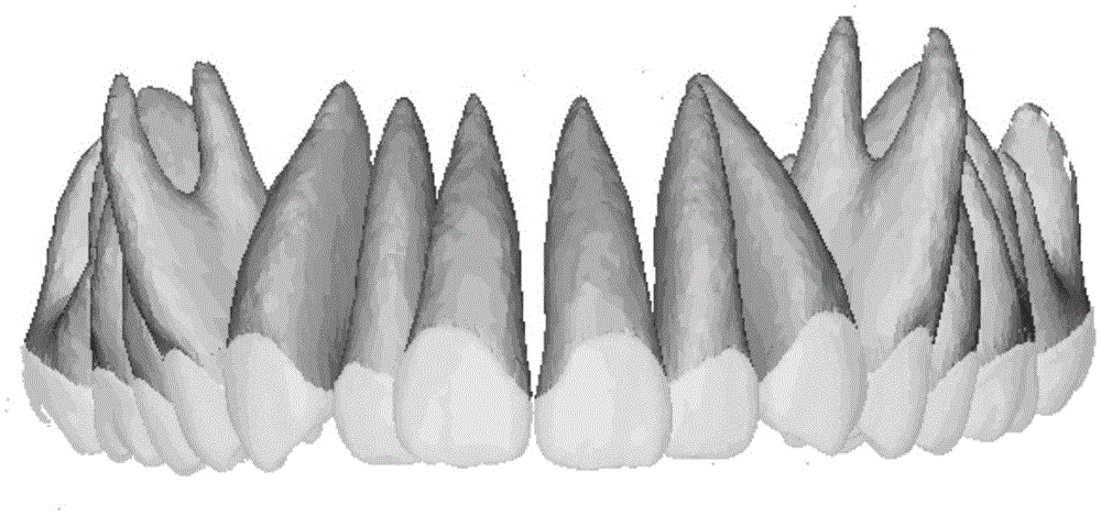 Method for reconstructing tooth root of patient